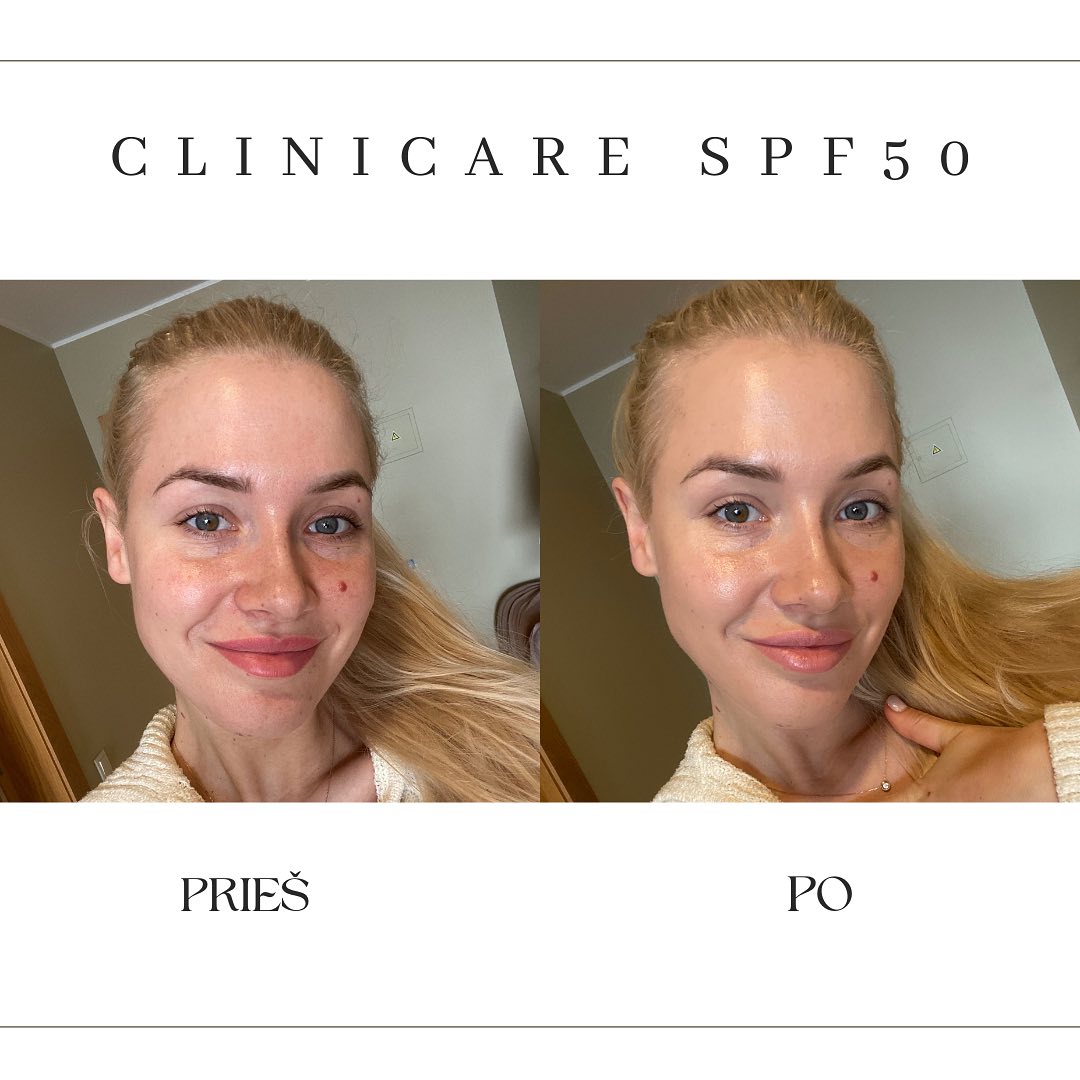CLINICCARE Dermo corrective kremas SPF50++ su spalva